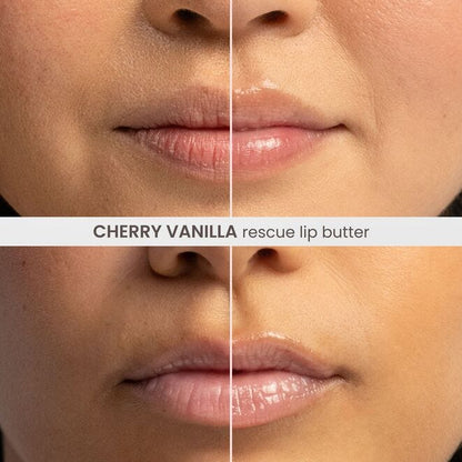Rescue Lip Butter - Cherry Vanilla - US 7618